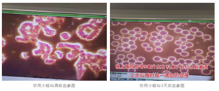 水蛭素、小蛭仙酒、醬香水蛭酒