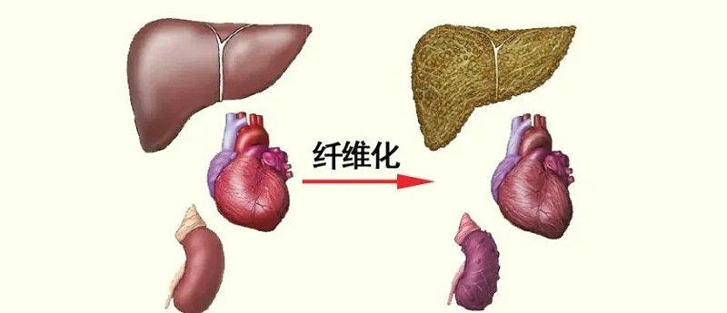 水蛭素、活血化瘀、纖維化