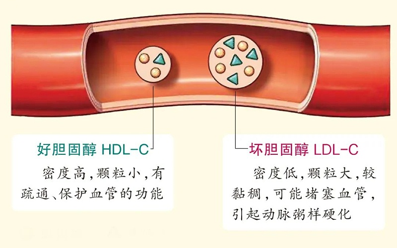 水蛭素、膽固醇、壯醫(yī)水蛭療法培訓(xùn)