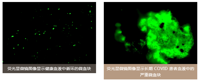 水蛭素、老年癡呆、前列腺、陽康