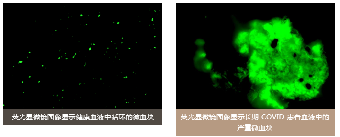 水蛭素、陽康、烏梅、壯醫(yī)水蛭療法