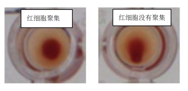 水蛭素、新冠病毒、壯醫(yī)水蛭療法