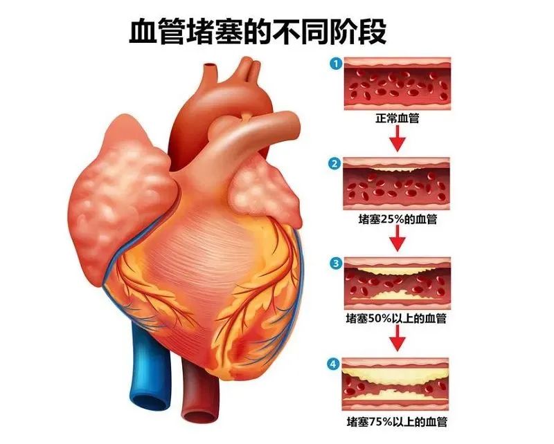 壯醫(yī)水蛭療法，天然水蛭素